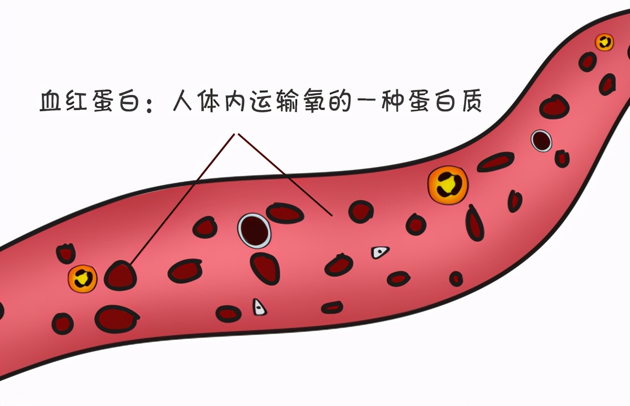 血常规检查化验单怎么看？医生：并不是有箭头就不正常