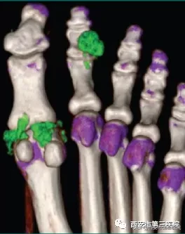 【四月回顾】西北大学附属医院•西安市第三医院动态“月”读