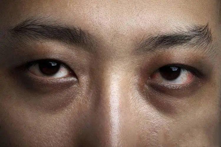 肝不好的人三黑两臭 肝不好三处发黄-百科叔叔