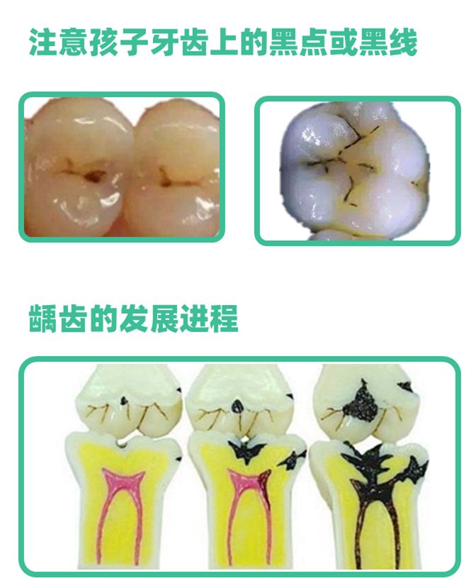 孩子眼睛发红、流黄鼻涕、大便发黑？出现这几种颜色，及时就医