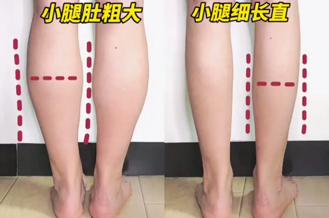 足弓垫瘦腿怎么使用（萝卜腿，可能是因为扁平足！教你一招建立足弓瘦小腿）