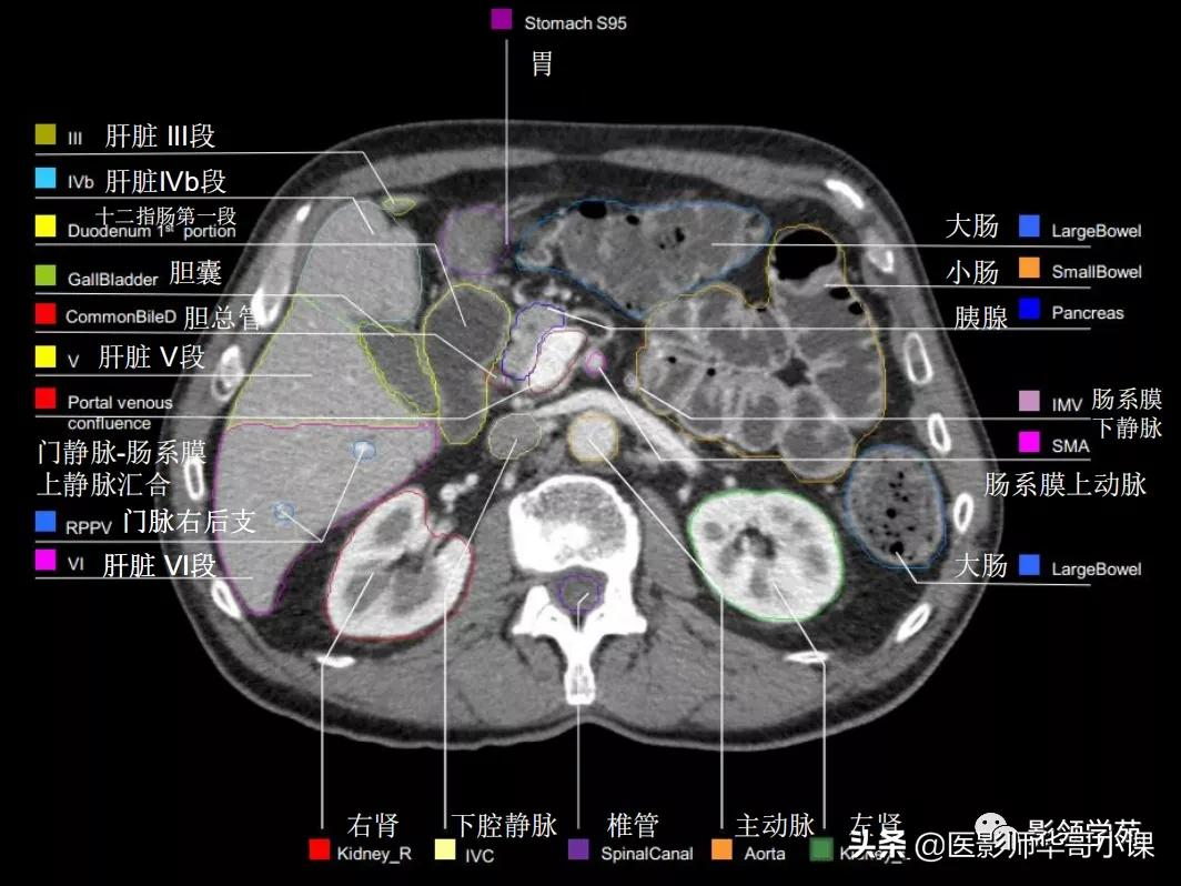 「高清解剖」腹部ct影像学解剖图谱(肝脏分叶分段)