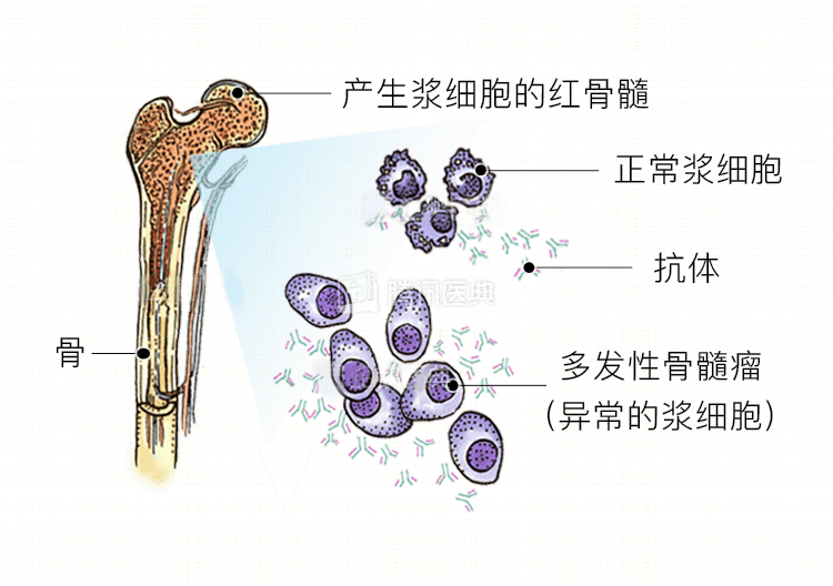 癌细胞几个月“消灭殆尽”！CAR-T疗法上市，我国迎来抗癌春天