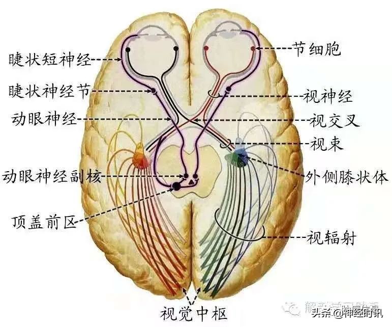 十二对颅神经解剖及损伤后表现