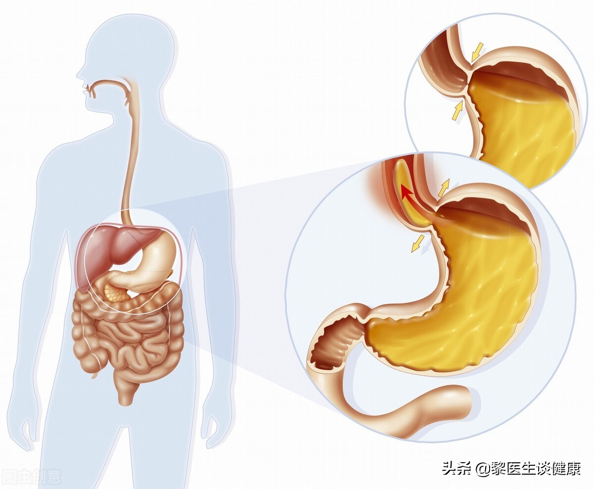 胸痛为何查胃镜？医生带你了解反流性食管炎如何发生？有何症状？