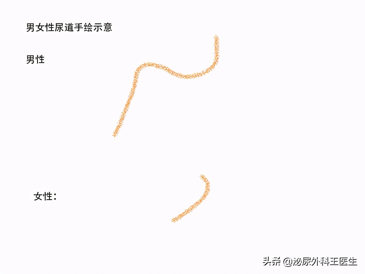 尿道炎和尿路石是同一个概念吗？为什么女性的尿道感染发病率高？