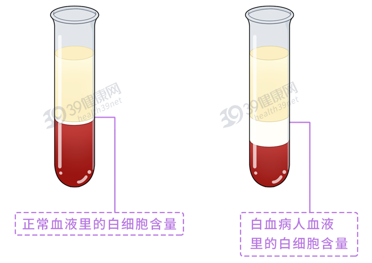 为什么越来越多的孩子得白血病？背后5个原因不容小觑，要远离