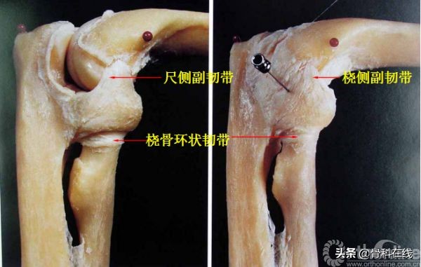 十分钟了解——让肘关节“恐怖三联征”不再恐怖