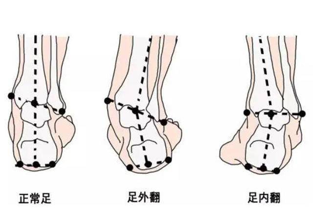 一双鞋穿两季？4岁内孩子足部发育关键期，分阶段选鞋别不舍得换