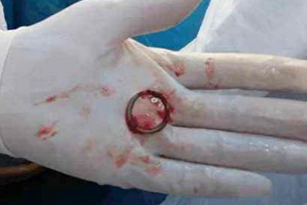 元宫环图片(首批) - 赤虎壹号