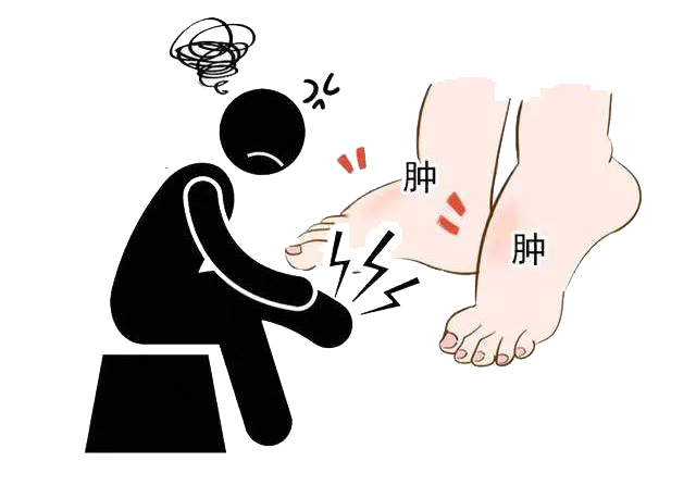 肾不好的人，为什么会水肿呢？怎么消肿？