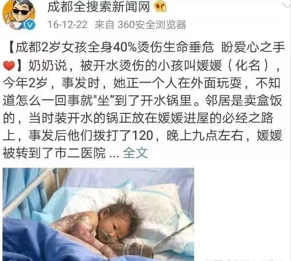用小太阳"取暖"，宝妈的一时疏忽，8个月宝宝大面积烧伤