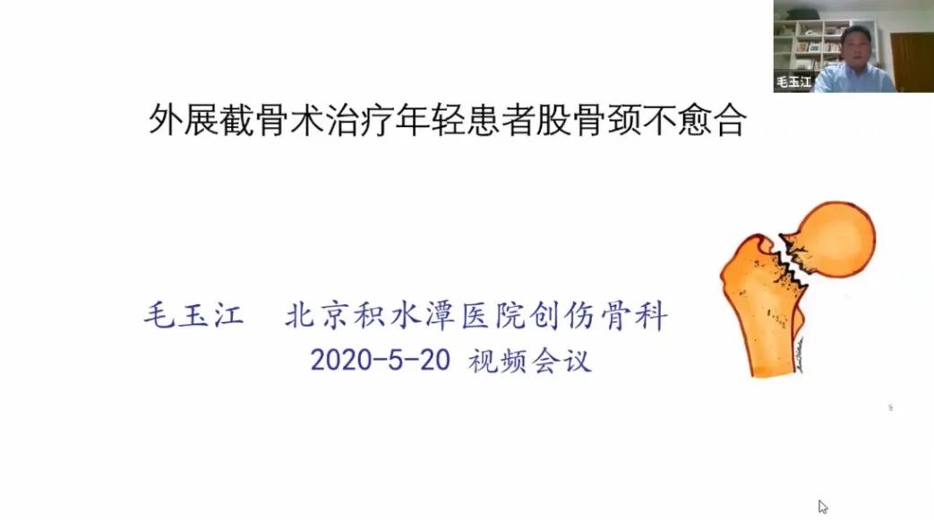 创伤骨科ERAS理念及实践推广项目线上系列活动之——股骨颈骨折专题