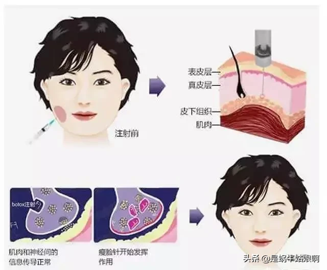 谁说你脸方是天生的?可能只是咬肌太大!4个动作帮你轻松瘦脸