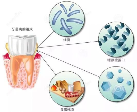 牙齒上黑黑的東西是什麼?知道真相,你會噁心的吐出來