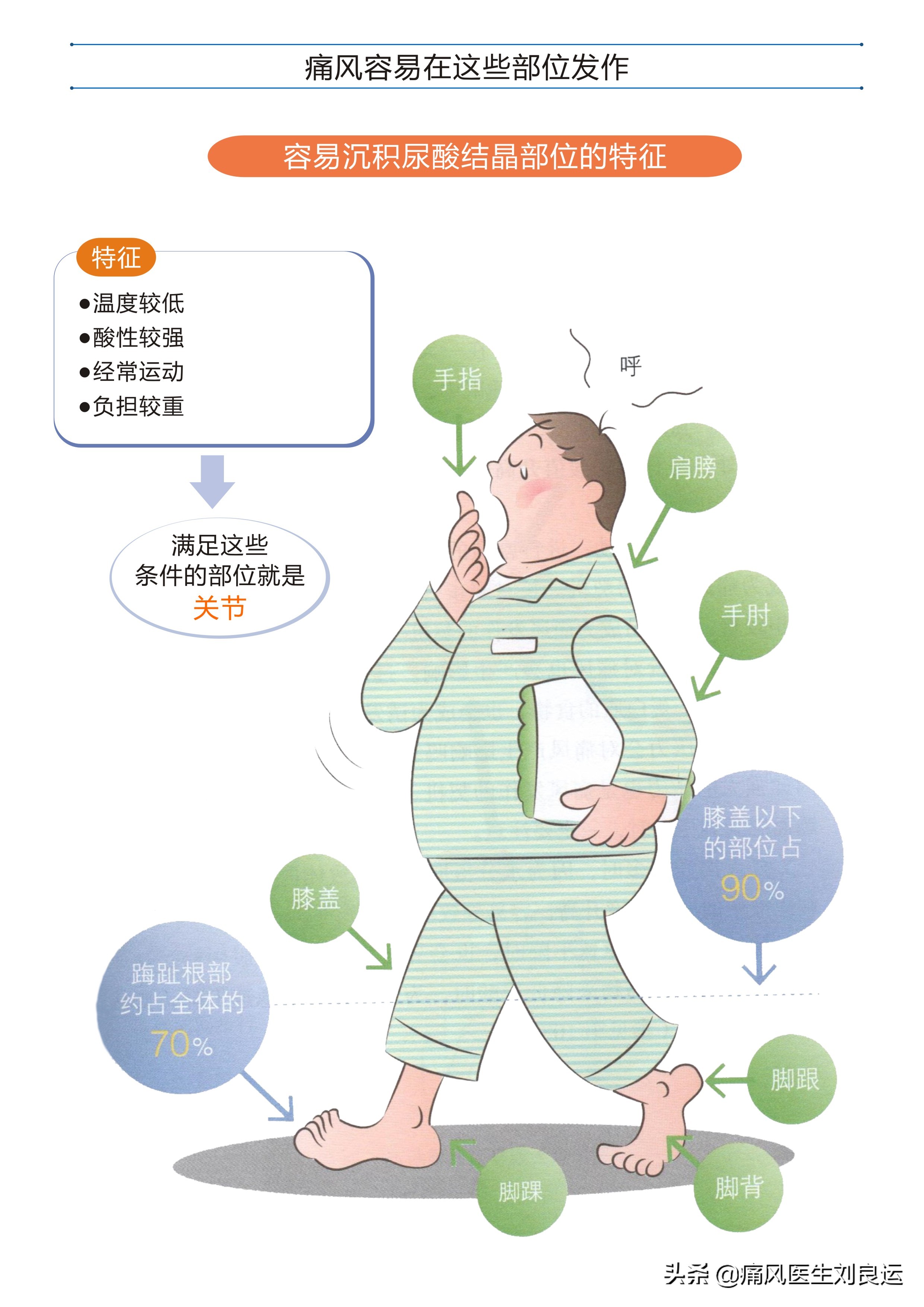 痛风急性发作只会在大脚趾上？不，手脚等四肢关节都可能发作