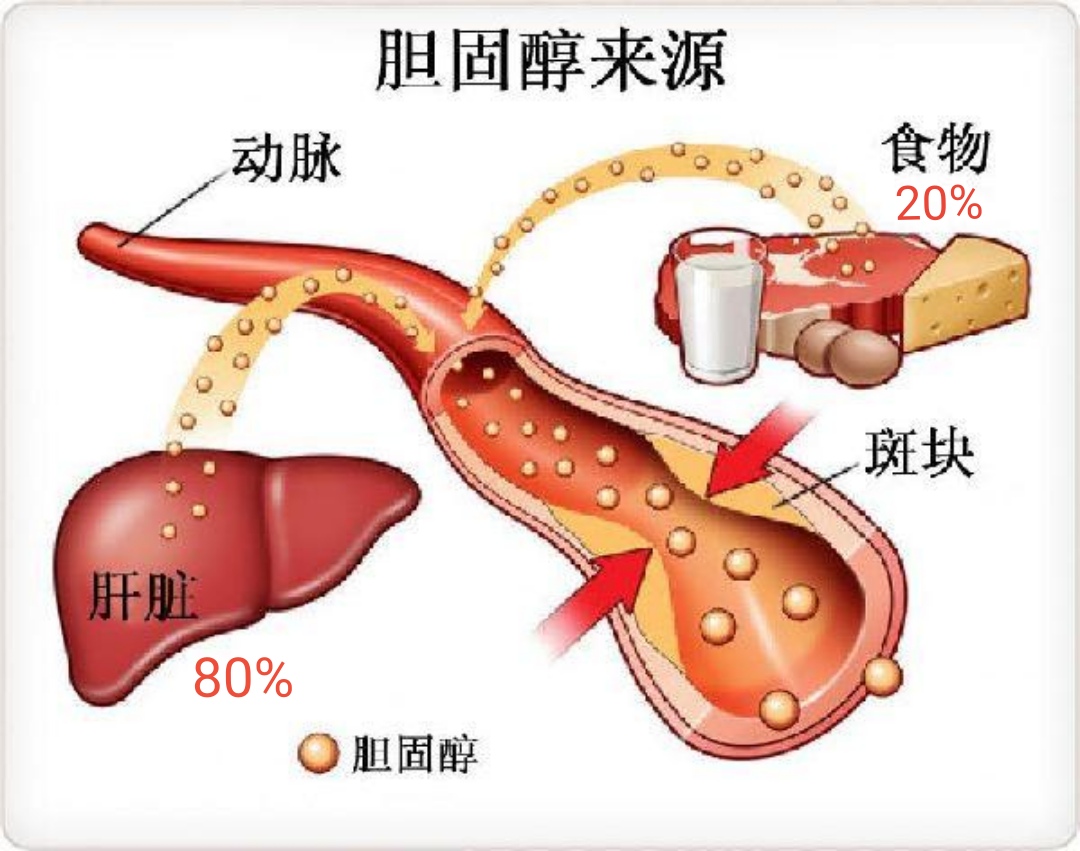 高胆固醇食物排行榜：哪些食物易导致胆固醇升高