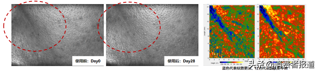 美容仪是“智商税”吗？近万条消费者口碑告诉你答案