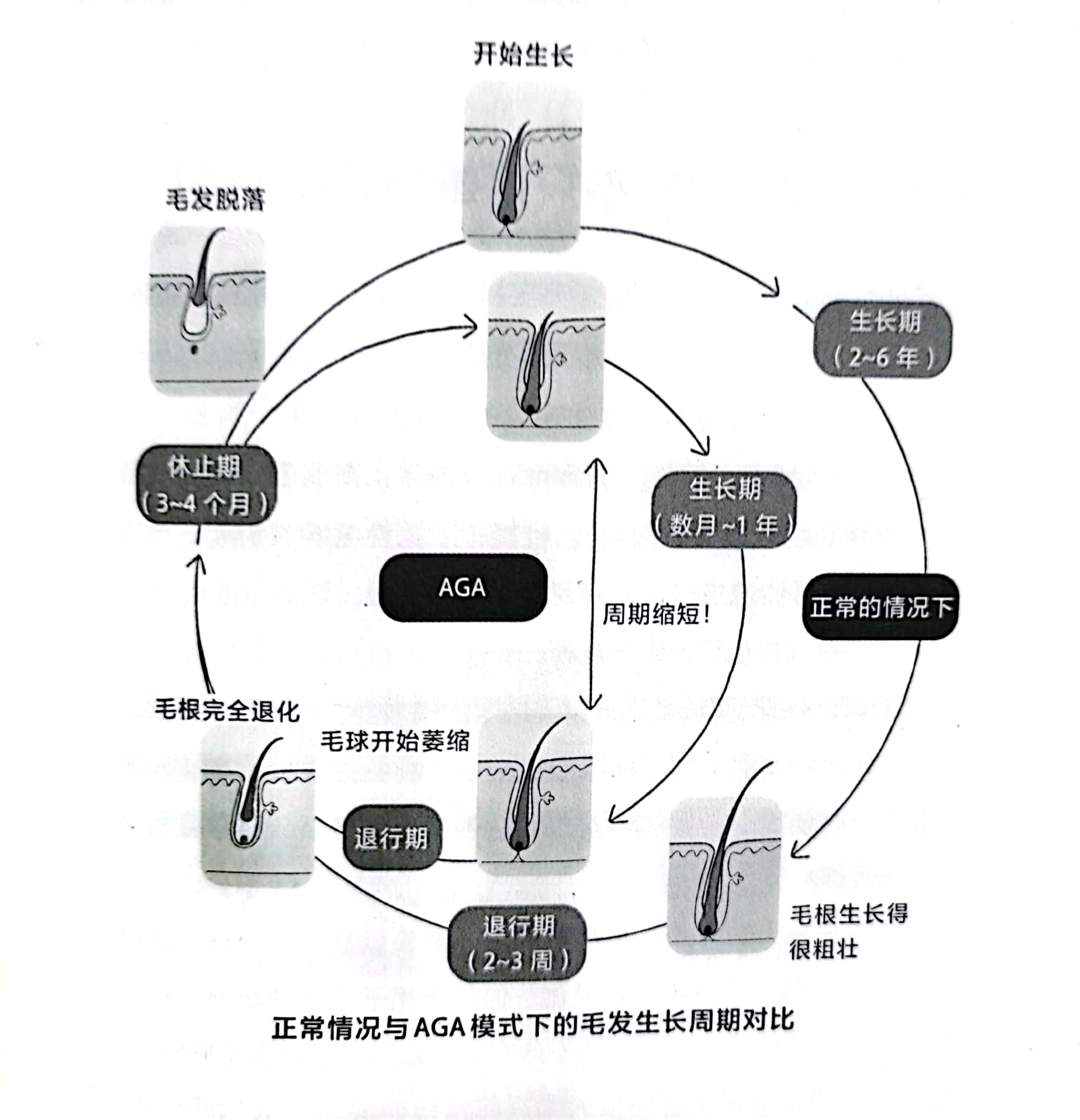 爸爸，为什么你没有头发？我这叫聪明绝顶