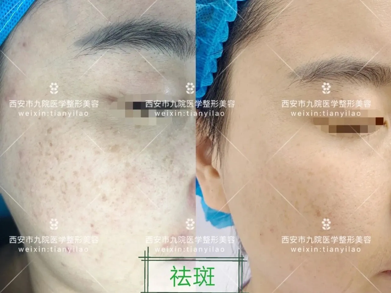 【活动播报】西安市第九医院“暑期特惠”活动启动啦!
