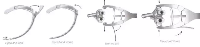 SEXTANT Ⅱ经皮椎弓根螺钉系统