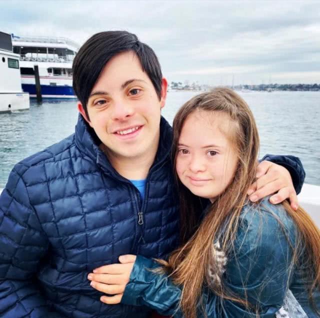 唐氏儿典型面容图片(出生被判定无法正常生活) - 赤虎壹号