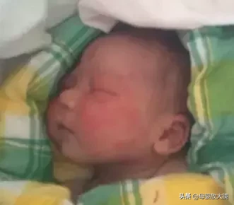 红斑、脱皮、痤疮…新生儿最易出现的10种皮肤问题，宝妈护理必备