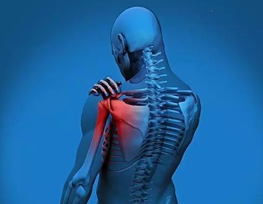 肩周炎是什么症状的图片（肩周炎的症状和部位）