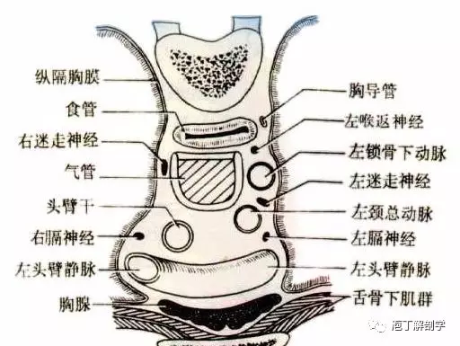 纵隔解剖 + 纵隔疾病X线诊断要点