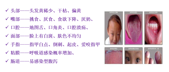 宝宝进入猛长季！钙、铁、锌、硒、DHA，这样食补更高效