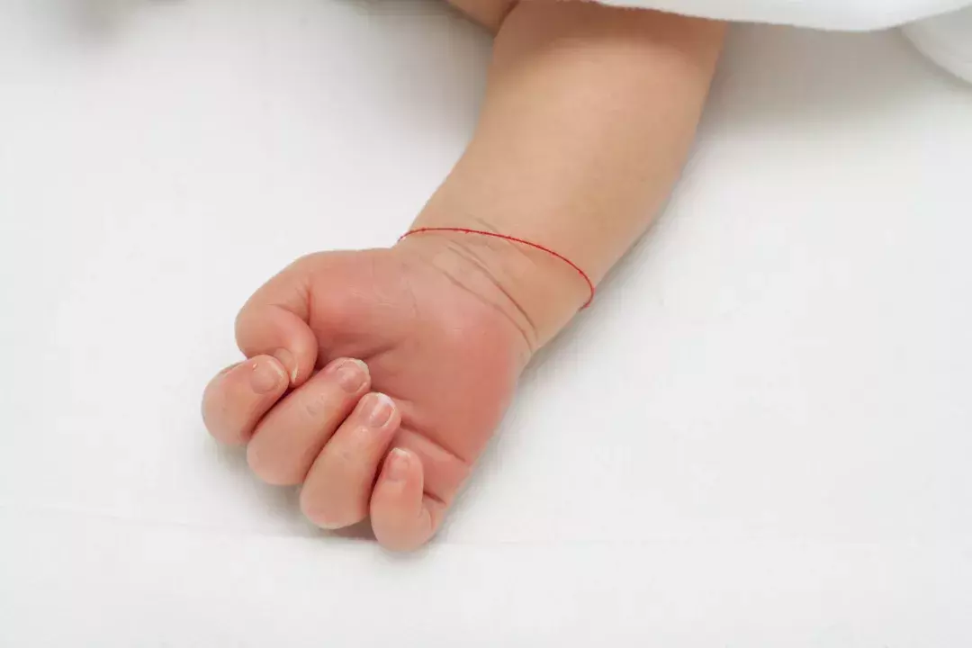 宝宝指甲上有白点是肚里有虫?真相你绝对想不到