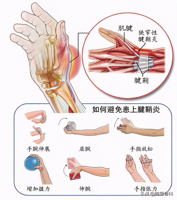 打篮球扭到膝盖里有响声(膝盖活动时“咔咔响”，这是病吗？主要看这 4 点)