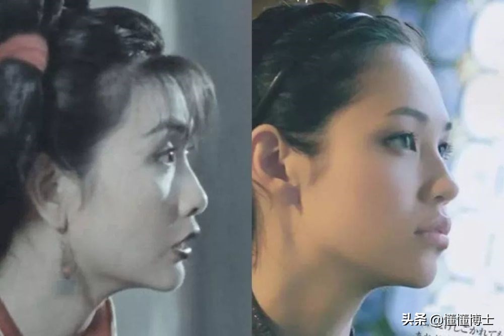 同样是凸嘴，为什么这些女明星就这么漂亮？两招教你摆脱土气脸