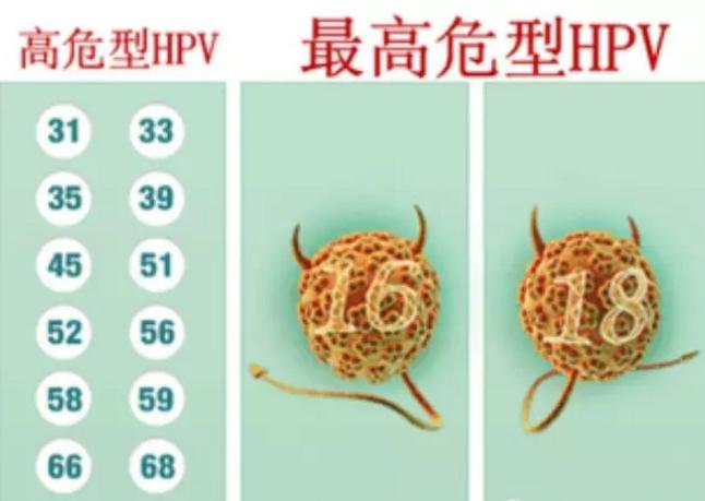 的宮頸癌相關的高危型hpv有14種,分別為hpv16,18,31,33,35,39,45,51