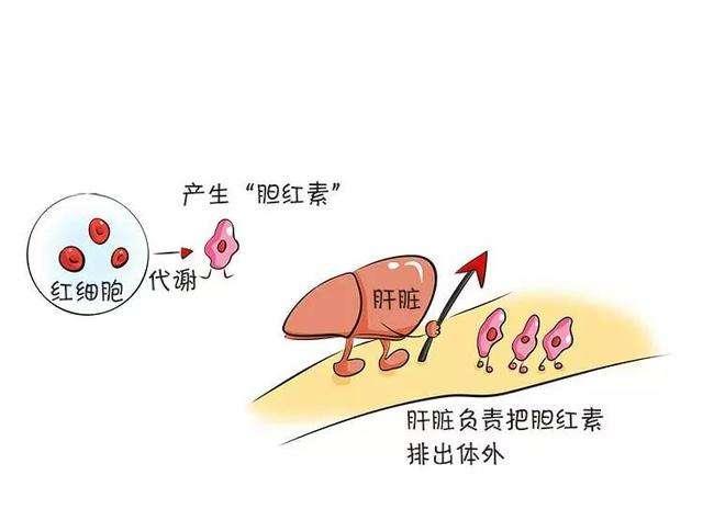 正常的大便为什么是黃色的？黑色，红色，绿色的大便是什么疾病？