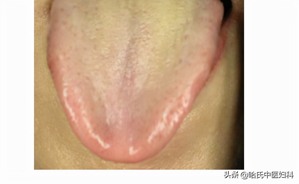 卵泡长不大长得慢？备孕女性这样做，轻松助好孕