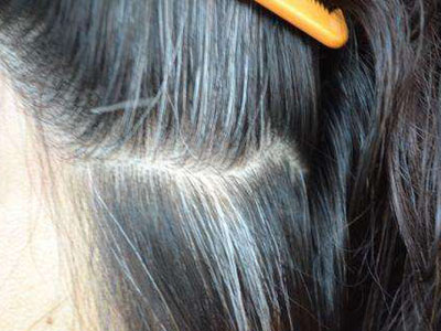 吃黑芝麻是养生还是伤身？带你看看关于黑芝麻，你需要知道的3点