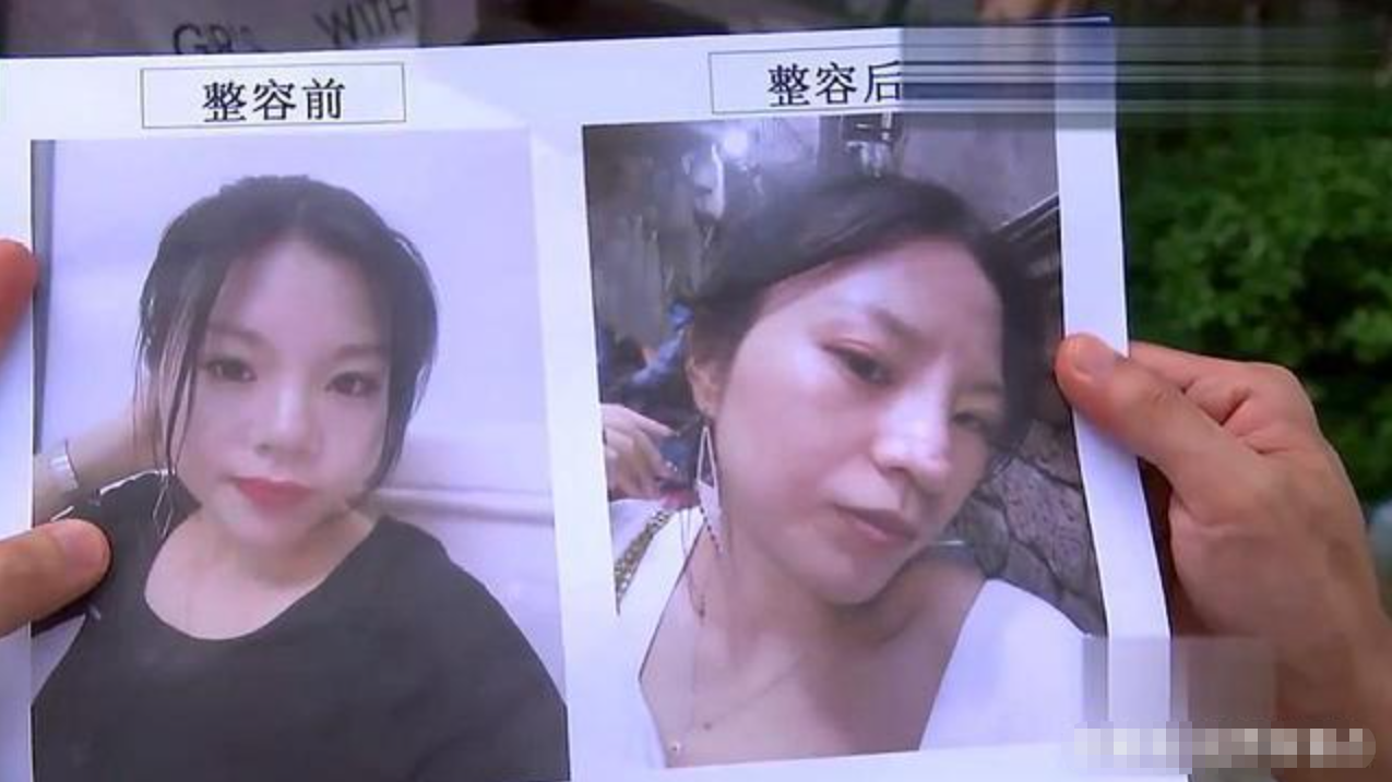 台州一女子去整形，花了4万给自己整个疤：活不下去了