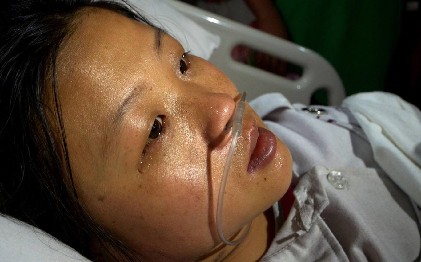 贫血会引起脸色苍白泛黄,尿毒症早期也会出现类似贫血的症状,乏力脸色