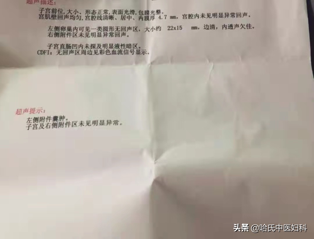 卵巢囊肿会导致不孕吗？卵巢囊肿的病因及预防，看这里