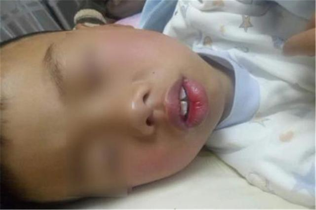 儿子脸型像“大猩猩”，妈妈调侃“长残了”，朋友提醒才知不对劲