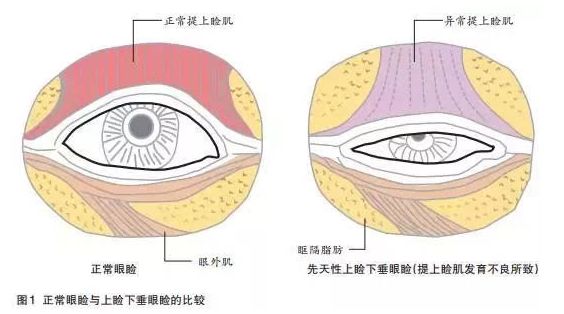  宝宝大小眼、眼皮一单一双、脸蛋不对称，妈妈们该怎么办