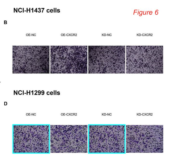 西安市胸科医院和西安交通大学第二附属医院发表的SCI论文被质疑