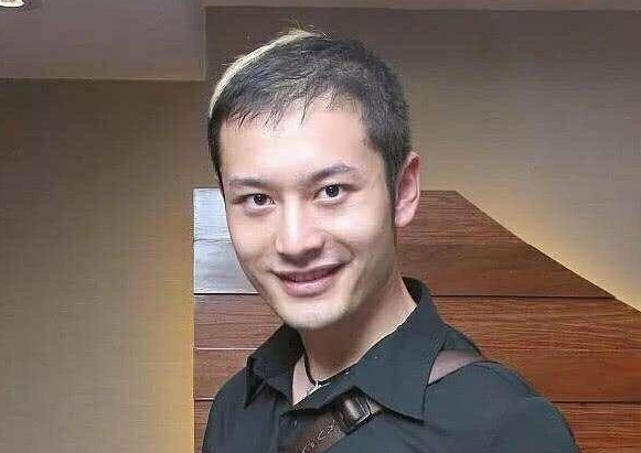 黄晓明因为发际线上热搜植来的美人尖太刻意照片前后对比明显