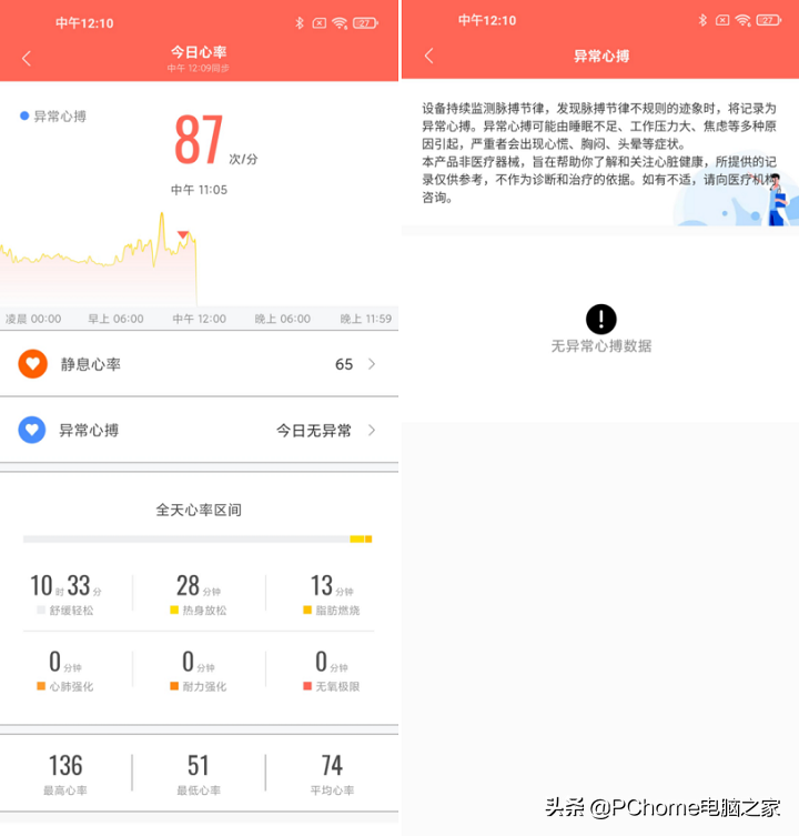 小米手环亮度怎么设置（1分钟学会调节手环亮度）