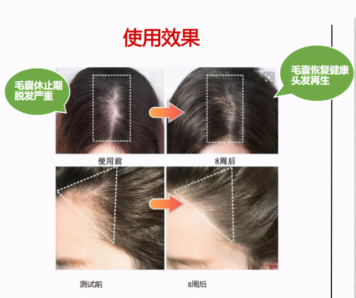 中国发证“认可”，脱发终于有救了