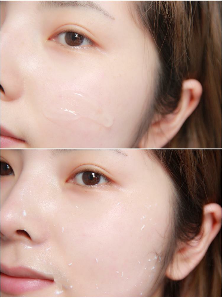 不少女生会因为过度去角质而变成了敏感肌,还有皮肤损伤造成的炎症