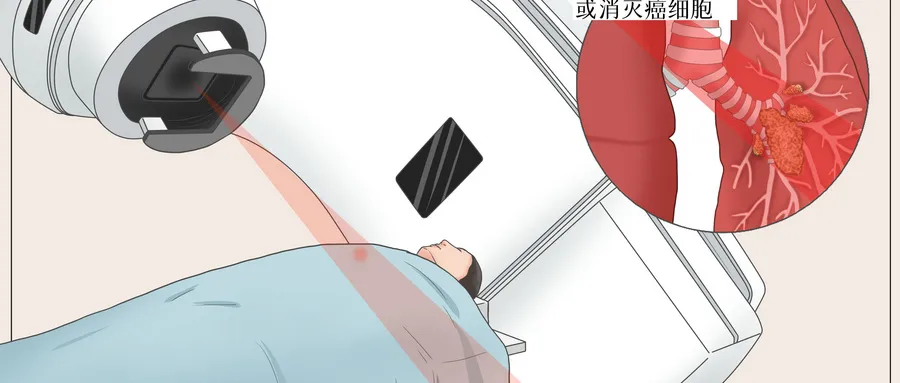 这种宫颈癌预后差,获取长生存期的秘诀是?
