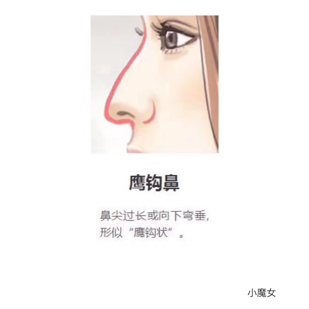 如何辨别自己的鼻型