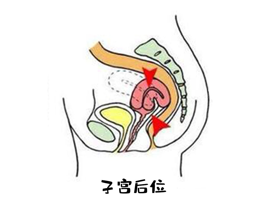 怀孕15周子宫位置图图片